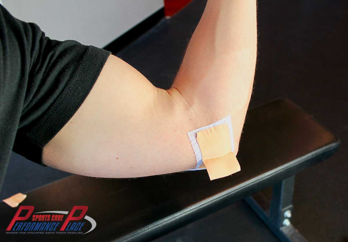 Tab Taping Elbow