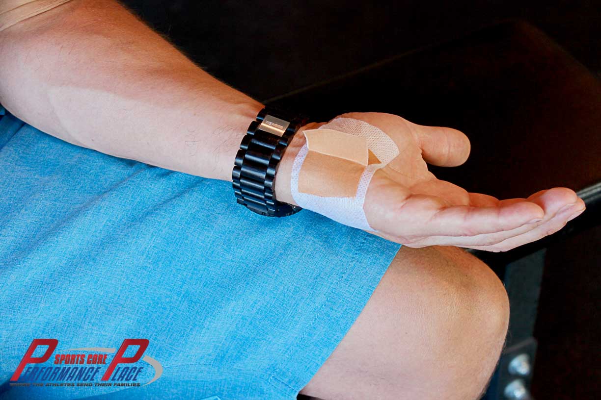 Tab Taping Cyclist Palsy Tab Taping Cyclist Palsy