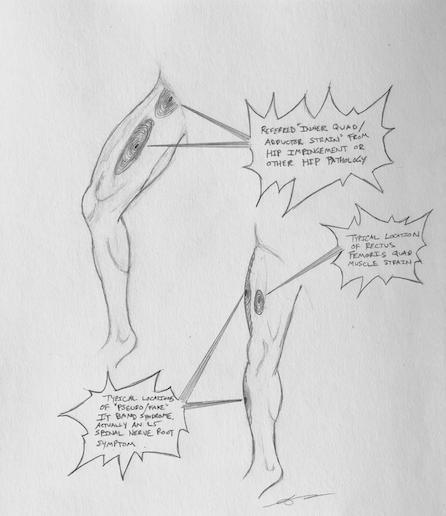 thigh pain when running thigh pain when running