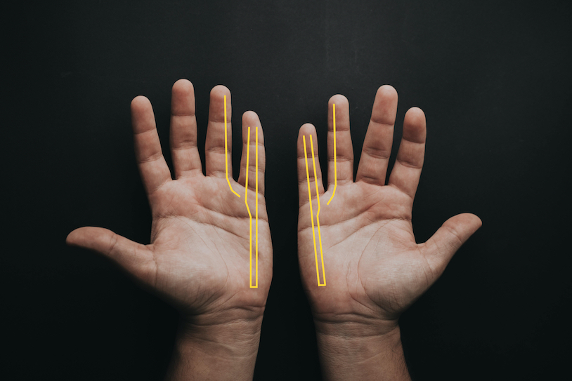 https://www.p2sportscare.com/wp-content/uploads/2022/08/ulnar-nerve-hands.jpg